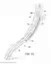 Fig. 10 - STENT PUSHER ASSEMBLY