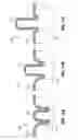 Fig. 09 - Reactive intragastric implant devices