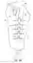 Fig. 19 - Methods and devices for providing automatic closure of prosthetics and orthotics