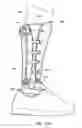 Fig. 29 - Methods and devices for providing automatic closure of prosthetics and orthotics
