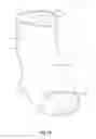 Fig. 02 - ORTHOPEDIC DEVICES, SYSTEMS, AND METHODS OF USE