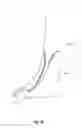 Fig. 07 - ORTHOPEDIC DEVICES, SYSTEMS, AND METHODS OF USE