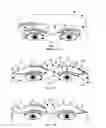 Fig. 02 - Method and Apparatus for Diverting Sweat, Liquid, Moisture, or the Like from an Eye