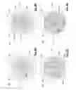 Fig. 04 - Bubble-free microfluidic valve systems and methods