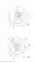 Fig. 04 - Apparatus and method for generating cut surfaces in the cornea of an eye for correction of ametropia