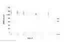 Fig. 09 - NOVEL CORE-SHELL NANOPARTICLES FOR ORAL DRUG DELIVERY