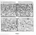 Fig. 04 - METHOD OF IMPROVING LIVER FUNCTION