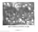 Fig. 03 - Small molecules modulator of epigenetic regulation and their therapeutic applications