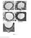 Fig. 28 - Pharmaceutical composition comprising bee venom-phospholipase A2 (BV-PLA2) for treating or preventing diseases related to degradation of abnormal regulatory T cell activity
