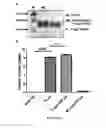 Fig. 40 - Pharmaceutical composition comprising bee venom-phospholipase A2 (BV-PLA2) for treating or preventing diseases related to degradation of abnormal regulatory T cell activity