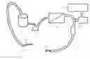 Fig. 01 - Methods of administering nitric oxide to arterial or arterialized blood