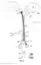 Fig. 09 - System and methods for lung isolation and one lung ventilation