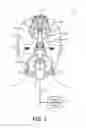 Fig. 02 - Patient interface system with articulating forehead pad attachment