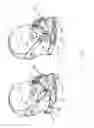Fig. 09 - CLOSURE METHODS AND DEVICES FOR HEAD RESTRAINTS AND MASKS