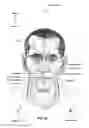 Fig. 05 - Nasal mask system