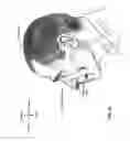 Fig. 07 - Nasal mask system
