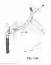 Fig. 30 - Nasal mask system