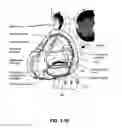 Fig. 32 - Nasal mask system