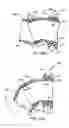 Fig. 52 - Nasal mask system