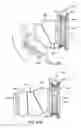 Fig. 56 - Nasal mask system
