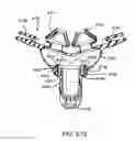 Fig. 64 - Nasal mask system