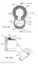 Fig. 69 - Nasal mask system