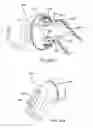 Fig. 75 - Nasal mask system