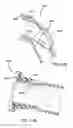 Fig. 76 - Nasal mask system