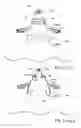 Fig. 84 - Nasal mask system