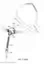 Fig. 92 - Nasal mask system