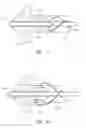 Fig. 06 - Safety needle assemblies and related methods