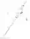 Fig. 02 - PRESSURE ACTUATED CATHETER SEAL AND METHOD FOR THE SAME
