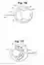 Fig. 09 - Electrical stimulation device and method for therapeutic treatment and pain management