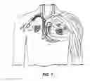 Fig. 09 - Systems and methods for estimating central arterial blood pressure of a patient