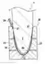 Fig. 01 - Method of fastening structural metal reinforcement on a portion of a gas turbine blade made of composite material, and an injection mold for performing such a method