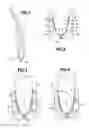 Fig. 02 - Method of fastening structural metal reinforcement on a portion of a gas turbine blade made of composite material, and an injection mold for performing such a method