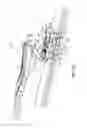 Fig. 08 - WIPER COUPLER ASSEMBLY AND WIPER ASSEMBLY INCORPORATING SAME