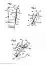 Fig. 02 - FLUID CONTAINER AND A VALVE FOR A FLUID CONTAINER