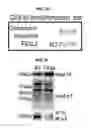 Fig. 09 - Benzathine analogs