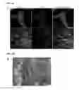 Fig. 17 - Generation of cardiomyocytes from human pluripotent stem cells