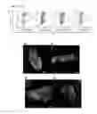 Fig. 20 - Generation of cardiomyocytes from human pluripotent stem cells