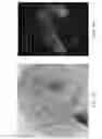 Fig. 09 - COMPOSITIONS AND METHODS FOR THE EXPRESSION OF A SEQUENCE IN A REPRODUCTIVE TISSUE OF A PLANT