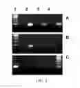 Fig. 02 - MYCOBACTERIUM TUBERCULOSIS DETECTION USING TRANSRENAL DNA