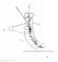 Fig. 01 - Device for shaping a thread-like material