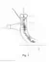 Fig. 02 - Device for shaping a thread-like material