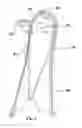 Fig. 07 - Inlet baffle assembly for an in-line interceptor