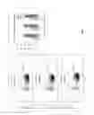 Fig. 09 - sAPP-alpha as a Biomarker for Prediction of Inflammatory and Autoimmune-Related Disorders