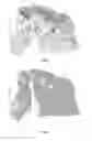 Fig. 03 - Method for quantifying immune cells in tumoral tissues and its applications