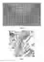 Fig. 04 - Method for quantifying immune cells in tumoral tissues and its applications