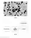 Fig. 06 - Method for quantifying immune cells in tumoral tissues and its applications